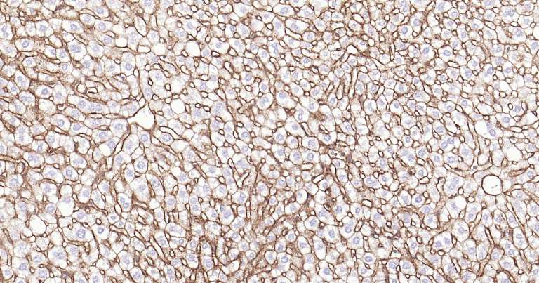 钠钾ATP酶蛋白a1即用型免疫组化试剂盒-IHC0259